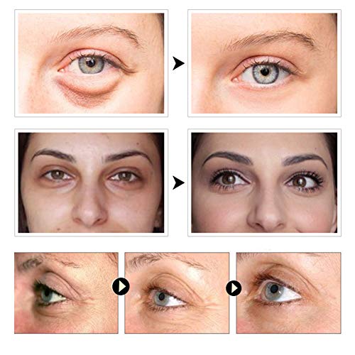 Eye Mask, Augenpads Augenringe, Anti Aging Pads, Collagen Maske, Augenpflege mit Hyaluron, Feuchtigkeit Spendende, Entfernen Taschen, Dunkle Kreise & Puffiness, 60pcs - 7